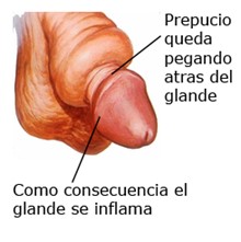 Anillo fimotico crema best sale